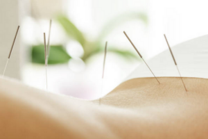 ACUPUNCTURE VIRGINIE GROS ISLE SUR LA SORGUE
